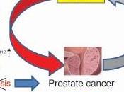 CANCER PROSTATE: stress réduit l’efficacité traitements Journal Clinical Investigation