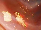 démo prévue pour Gears Judgment.