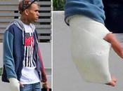 Chris brown platre main