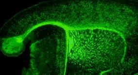 SCLÉROSE en plaques: La testostérone pour régénérer la myéline – CNRS et Brain