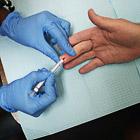 Incidence d’infections HIV chez des hommes entretenant des relations sexuelles avec des hommes en Angleterre et Pays de Galles (2001-2010): étude de cohorte à l’échelle nationale