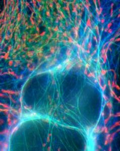 CANCER: Un mécanisme qui bloque la croissance des cellules cancéreuses – Journal of Cell Science