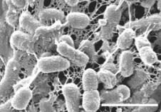 CROHN, GÉNOME et microbiote: Un gène influence la flore intestinale – Gut