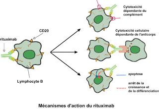 Bendamustine + rituximab versus CHOP + rituximab comme traitement de première ligne chez des patients atteints de lymphome indolent et de lymphome du manteau : un essai de non-infériorité de phase 3, ouvert et multicentrique