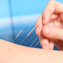 L'acupuncture pour soulager les allergies 