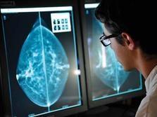 CANCER du SEIN: Le diagnostic désormais possible en 24 heures – Réseau CHU