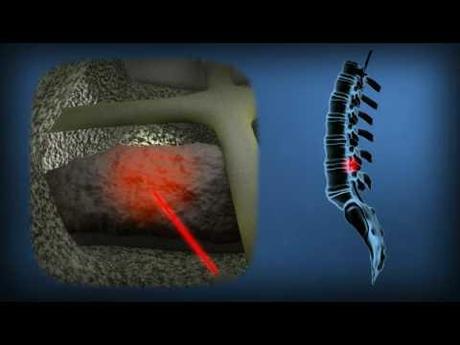 Microchirurgie Microchirurgie
