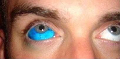 EYE BALL TATTOO OU YEUX DE BILLES : LE TATOUAGE DES YEUX ET PLUS PRECISEMENT DE LA CORNEE