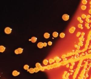 RÉSISTANCE: Montée des infections nosocomiales mortelles à entérobactéries  – CDC