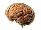 Nouvelle recherche: cerveau obèses moins efficace