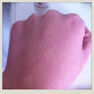 Quand Ren vole au secours de ma peau