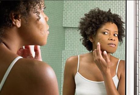 BEAUTE : 10 ERREURS FATALES A NE PLUS COMMETTRE Trop traiter ses boutons d'acné