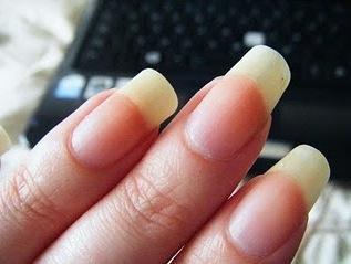 BEAUTE : 10 ERREURS FATALES A NE PLUS COMMETTRE Les ongles jaunes