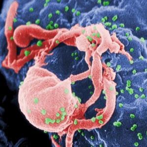 VIH: Infection bien contrôlée, pas plus de risque de décès – AIDS