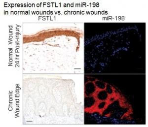 PLAIES CHRONIQUES: Pourquoi la cicatrisation, parfois, ne vient pas – Nature