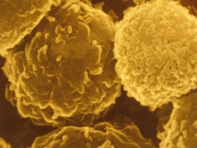 Allô patients allogreffés ? – Webzine de l’AP-HP