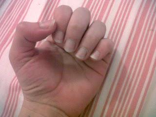 Enfin mes ongles se soignent: le verdict