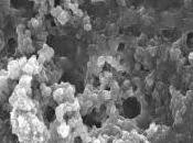 BIOTECHS Intoxications alimentaires: nanoparticules dévoreuses Listeria Nature Scientific Reports