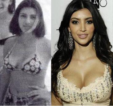 Kim Kardashian : chirurgie de la poitrine