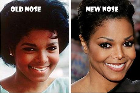 Janet Jackson (jeune) : avant/après chirurgie du nez