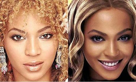 Beyonce : chirurgie du nez