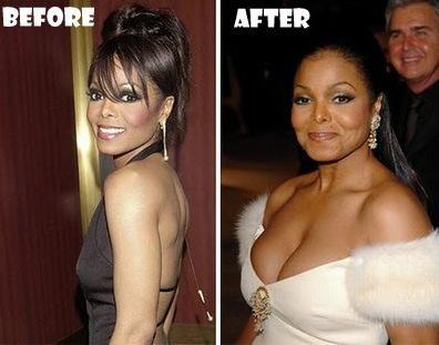 Janet Jackson (jeune) : avant/après chirurgie du nez