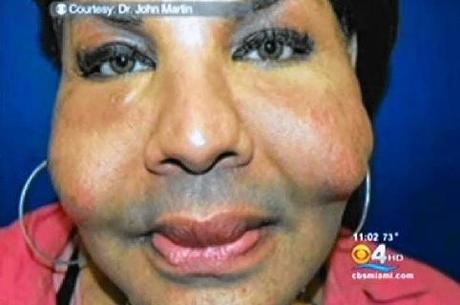 La victime transexuelle d'Oneal Ron morris révélait son visage : Rajee Rajindra Narinesingh