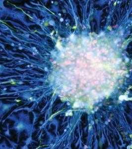 Le CERVEAU aussi fait son nettoyage de printemps  – Nature Neuroscience