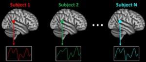 AUTISME: Des cerveaux différents mais des réponses similaires à la musique – European Journal of Neuroscience
