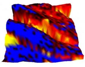 DIABÈTE: Quand l'hyperglycémie coupe la respiration et la circulation – Physical Review Letters