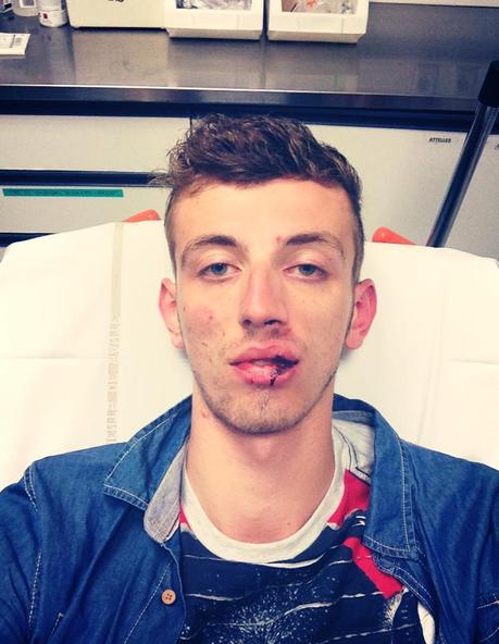 Nouvelle agression homophobe Nice