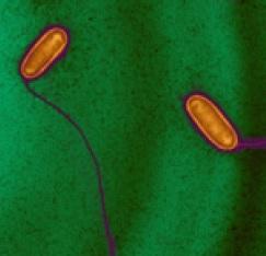 LÉGIONELLA: Pour mieux infecter, elle maîtrise l'épigénétique  – Cell Host & Microbe