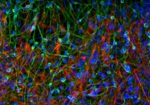 NEURO: Ils restaurent la mémoire par greffe de cellules souches – Nature Biotechnology