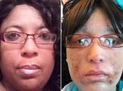 reaction allergique transforme cheveux ongles enfer