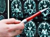 ÉPILEPSIE: premier dispositif prédit crises Lancet Neurology