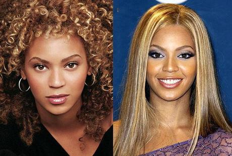 Chirurgie esthétique : Beyonce serait refaite de A à Z !