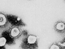 Santé nouveau coronavirus touché France