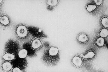 Santé : le nouveau coronavirus a touché la France
