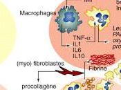 Chronologie l’identification lésions histologiques dans syndrome détresse respiratoire aiguë avec dommage alvéolaire diffus: étude prospective cohorte d’autopsies cliniques