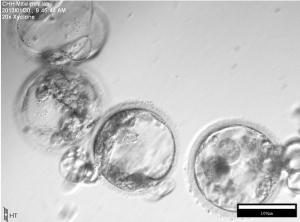 Le CLONAGE pour transformer des cellules de peau en cellules souches embryonnaires – Cell