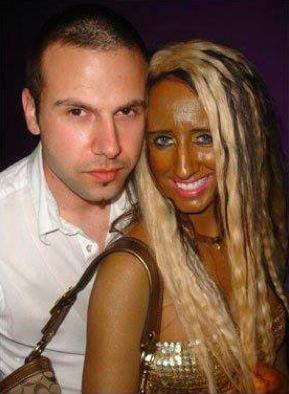 Une fille blanche devenue noire - abus de cabines de bronzage
