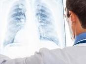 VITAMINE réduit l'inflammation dans l'asthme sévère Journal Allergy Clinical Immunology