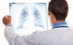 La VITAMINE D réduit l'inflammation dans l'asthme sévère  – The Journal of Allergy and Clinical Immunology