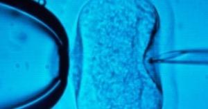 FIV: Une nouvelle technique d'imagerie double le taux de réussite  – Reproductive BioMedicine Online