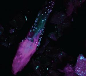 MICROBIOME de la PEAU: Ces 80 champignons qui poussent sur notre corps – NIH