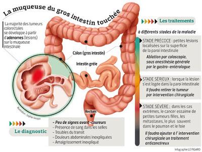 Mesure des taux de croissance volumétrique de petits polypes colorectaux par colographie TDM* : étude longitudinale d’une histoire naturelle