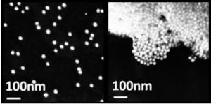 SARCOME de KAPOSI: Le détecter avec un smartphone – CLEO 2013