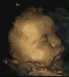 DÉVELOPPEMENT: Le visage du foetus exprime-t-il une émotion?  – PLoS ONE