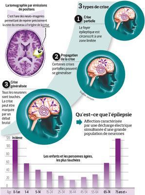 Expression et fonction de glycoprotéine P chez des patients atteints d’épilepsie du lobe temporal : étude cas – témoins