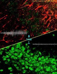 ÉPILEPSIE: Une cible moléculaire pour l'empêcher de s'installer – Neuron